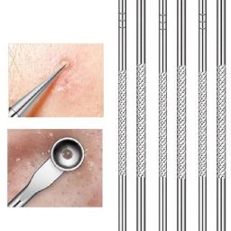 Stainless Steel Blackhead Remover Needle-image-76
