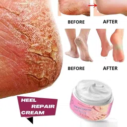 Foot Cream For Rough, Dry and Cracked Heel, Feet Cream For Heel Repair-image-46