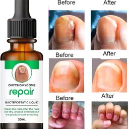 Nail Serum Boost Nail Growth, Strong & Nail repair treatment serum White-image-41