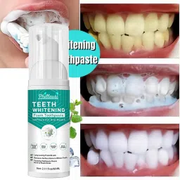Teeth Foam teeth whitening foam cleaner, Gentle Formula for a Radiant Smile Toothpaste-20