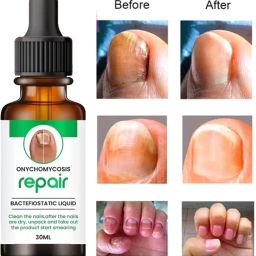 Nail Serum - Boost Nail Growth, Strong and Repair Nails, Cuticle clear-image-42