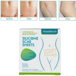 Silicon gel sheets for Scars C-Section, Deep Stretch Mark Removal Crepe Bandage-image-37