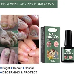Nail Fungus Treatment And Repair Foot Removal Toe Fungal Infection Liquid-image-44