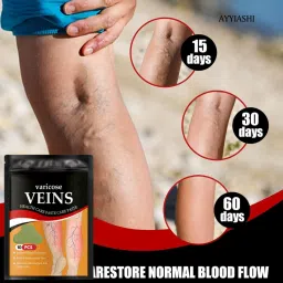 ayyiashi Advanced Formula Varicose Veins Patch for Blood Flow Plaster & Patch image 5
