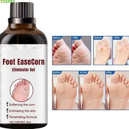 ayyiashi Foot Ease Corn Quick Relief 30ml Daily Safe Unisex Comfort Care Solution-picture-37