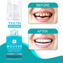 Teeth Whitening pack of 1 Teeth Whitening Liquid-image-81