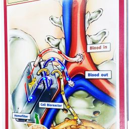melody's Artificial Kidney Biology Working Science Project Model. image 3
